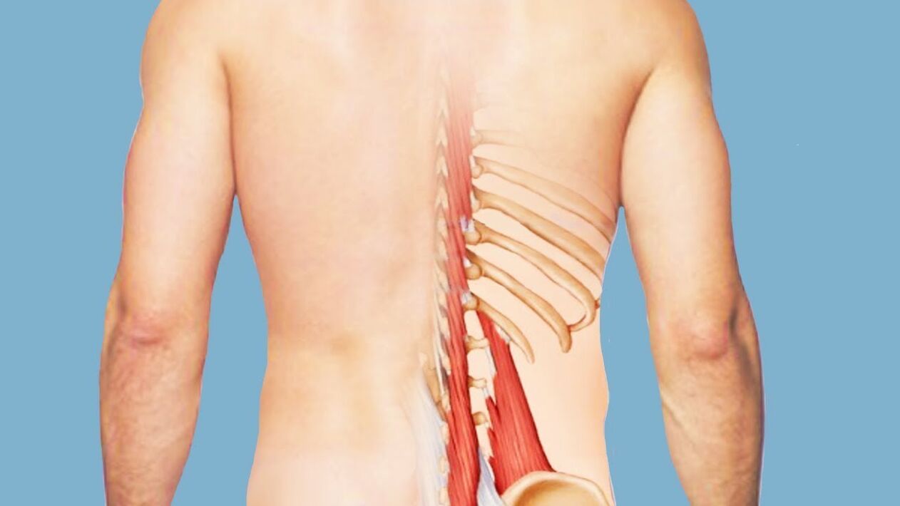 Myositis als Ursache für Rückenschmerzen